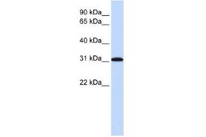 RPA4 antibody used at 1 ug/ml to detect target protein. (RPA4 antibody  (Middle Region))