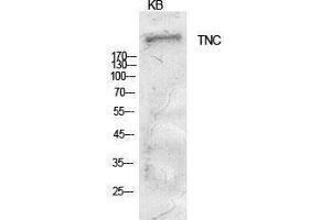 Western Blotting (WB) image for anti-Tenascin C (TNC) (Internal Region) antibody (ABIN6285637) (TNC antibody  (Internal Region))