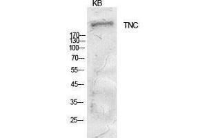 Western Blotting (WB) image for anti-Tenascin C (TNC) (Internal Region) antibody (ABIN3181403) (TNC antibody  (Internal Region))