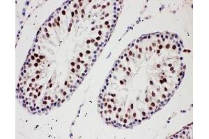 Immunohistochemistry (IHC) image for anti-Protein Inhibitor of Activated STAT, 1 (PIAS1) (AA 636-651) antibody (ABIN3032369)