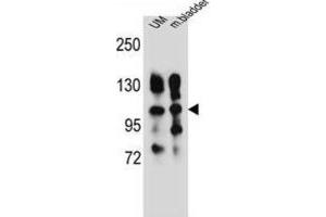 Western Blotting (WB) image for anti-Integrin, alpha 5 (ITGA5) antibody (ABIN2996588)