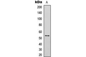 Western blot analysis of p53 (pS392) expression in SKOV3 Etoposide-treated (A) whole cell lysates. (p53 antibody  (C-Term, pSer392))