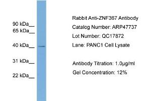 WB Suggested Anti-ZNF367  Antibody Titration: 0. (ZNF367 antibody  (Middle Region))