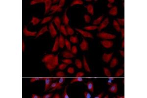 Immunofluorescence analysis of U2OS cells using UBE2I Polyclonal Antibody (UBE2I antibody)