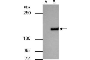 IP Image ROCK1 antibody immunoprecipitates ROCK1 protein in IP experiments. (ROCK1 antibody  (N-Term))