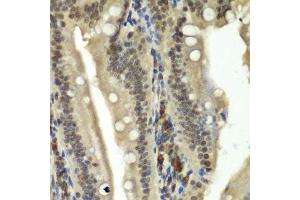 Immunohistochemistry (Paraffin-embedded Sections) (IHC (p)) image for anti-Retinoblastoma Binding Protein 5 (RBBP5) (AA 319-538) antibody (ABIN6146741)