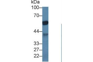 Western Blot; Sample: Porcine Cerebrum lysate; Primary Ab: 1µg/ml Rabbit Anti-Human PPP1Ca Antibody Second Ab: 0. (PPP1CA antibody  (AA 2-330))