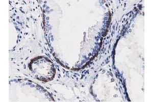 Immunohistochemical staining of paraffin-embedded Human Kidney tissue using anti-ALDH1L1 mouse monoclonal antibody. (ALDH1L1 antibody)