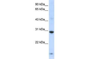WB Suggested Anti-ZNF138 Antibody Titration:  0. (ZNF138 antibody  (Middle Region))