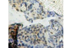 Used in DAB staining on fromalin fixed paraffin-embedded Ovary tissue (BCL9 antibody  (AA 1119-1328))
