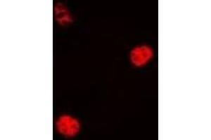 Immunofluorescent analysis of Cyclin C staining in Hela cells. (Cyclin C antibody)