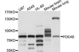 Western blot analysis of extracts of various cell lines, using PDE4B antibody (ABIN4904711) at 1:1000 dilution. (PDE4B antibody)