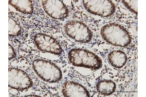 Immunoperoxidase of monoclonal antibody to CHD3 on formalin-fixed paraffin-embedded human colon.