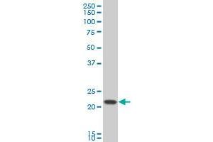 GNPNAT1 polyclonal antibody (A01), Lot # 051116JC01 Western Blot analysis of GNPNAT1 expression in HeLa . (GNPNAT1 antibody  (AA 1-90))
