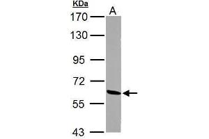 Western Blotting (WB) image for anti-Malic Enzyme 1, NADP(+)-Dependent, Cytosolic (ME1) antibody (ABIN2855777)