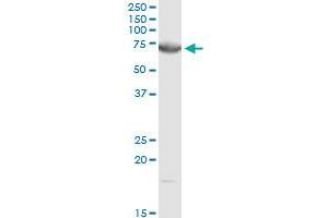 DMPK MaxPab rabbit polyclonal antibody. (DMPK antibody  (AA 1-629))