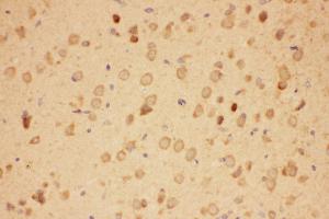 Immunohistochemistry (IHC) image for anti-Heat Shock Protein 90kDa alpha (Cytosolic), Class A Member 1 (HSP90AA1) (AA 2-365) antibody (ABIN3043847)