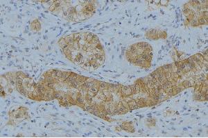ABIN6266597 at 1/100 staining Human uterus tissue by IHC-P. (MMP7 antibody  (C-Term))