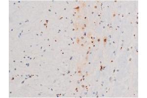 Immunohistochemistry (IHC) image for anti-GATA Binding Protein 4 (GATA4) (pSer105) antibody (ABIN6256094)