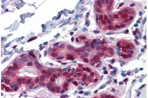 Human Breast: Formalin-Fixed, Paraffin-Embedded (FFPE) (YAP1 antibody  (AA 53-162))
