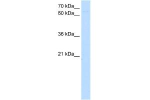 WB Suggested Anti-ZKSCAN1 Antibody Titration:  5. (ZKSCAN1 antibody  (N-Term))