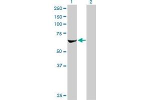 Western Blot analysis of RPS6KB2 expression in transfected 293T cell line by RPS6KB2 monoclonal antibody (M08), clone 4B11. (RPS6KB2 antibody  (AA 1-100))