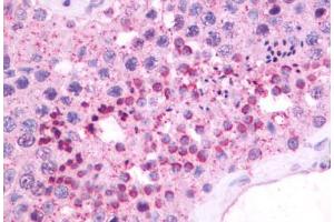 Anti-NMBR antibody IHC staining of human testis. (NMBR antibody  (Cytoplasmic Domain))