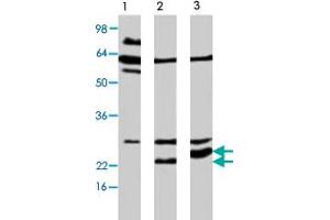 Western blot analysis of extract from Neuro 2a cells, using APH1A polyclonal antibody  . (APH1A antibody)