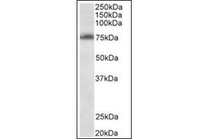 Staining of Jurkat lysate (35µg protein in RIPA buffer) using TSPYL2 antibody at 0. (TSPY-Like 2 antibody  (Internal Region))
