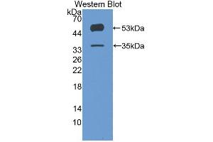 Western blot analysis of the recombinant protein. (ANGPTL4 antibody  (AA 182-388))