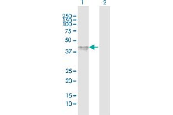 IL12RB1 antibody  (AA 1-381)