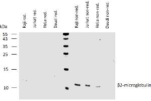 Western blotting analysis of human β2-microglobulin using mouse monoclonal antibody B2M-01 on lysates of various cell lines under reducing and non-reducing conditions.