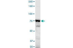 ADD3 polyclonal antibody (A01), Lot # CHI0060725QCS1. (ADD3 antibody  (AA 462-560))