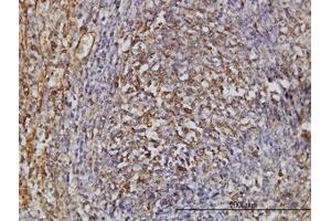 Image no. 1 for anti-Thiopurine S-Methyltransferase (TPMT) (AA 1-246) antibody (ABIN598985) (TPMT antibody  (AA 1-246))