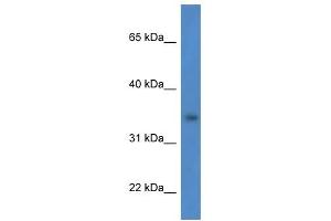 Western Blot showing HSDL1 antibody used at a concentration of 1 ug/ml against HCT15 Cell Lysate