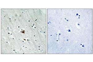 Immunohistochemical analysis of paraffin-embedded human brain tissue using MAPKAPK2 (Phospho-Ser272) antibody (left)or the same antibody preincubated with blocking peptide (right). (MAPKAP Kinase 2 antibody  (pSer272))