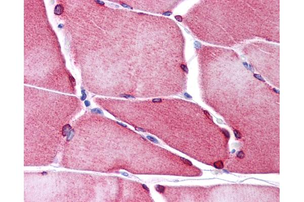 TMEM38A antibody  (C-Term)
