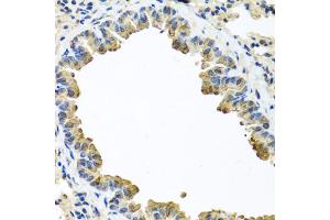 Immunohistochemistry of paraffin-embedded mouse lung using SERPINA3 antibody (ABIN5970399) at dilution of 1/100 (40x lens). (SERPINA3 antibody)