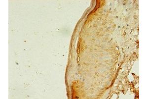 Immunohistochemistry of paraffin-embedded human skin tissue using ABIN7144485 at dilution of 1:100 (APAF1 antibody  (AA 104-415))