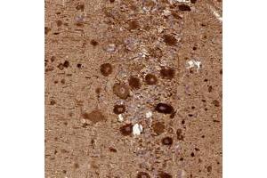 Immunohistochemical staining of human cerebellum with BCDIN3D polyclonal antibody  shows strong cytoplasmic positivity in purkinje cells at 1:50-1:200 dilution. (BCDIN3D antibody)