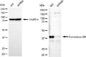 Western blotting analysis using homeobox D9 antibody (ABIN7798995). (HOXD9 antibody)