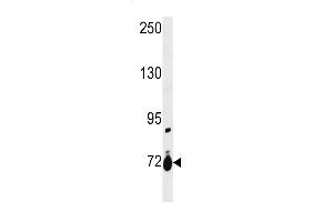 SLC28A1 Antibody (Center) (ABIN1881811 and ABIN2843229) western blot analysis in ZR-75-1 cell line lysates (35 μg/lane). (SLC28A1 antibody  (AA 381-409))