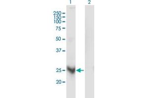 MARCH3 antibody  (AA 1-100)