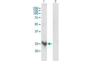 Western Blot analysis of MARCH3 expression in transfected 293T cell line by MARCH3 monoclonal antibody (M03), clone 1F6.