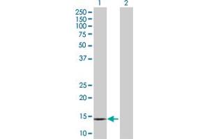 Western Blotting (WB) image for PPBP 293T Cell Transient Overexpression Lysate(Denatured) (ABIN1333035)