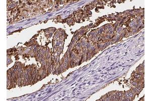 ABIN6268717 at 1/100 staining Human lung tissue by IHC-P.