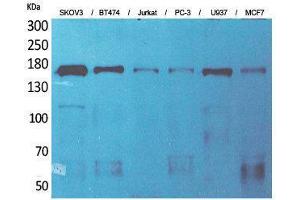 Western Blotting (WB) image for anti-Sterol Carrier Protein 2 (SCP2) (Internal Region) antibody (ABIN3187668) (SCP2 antibody  (Internal Region))