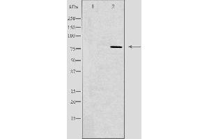 Western blot analysis of extracts from HeLa cells, using GUSB antibody. (Glucuronidase beta antibody  (Internal Region))