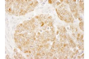 Immunohistochemistry (IHC) image for anti-Insulin Receptor Substrate 1 (IRS1) (AA 1192-1242) antibody (ABIN7448979) (IRS1 antibody  (AA 1192-1242))