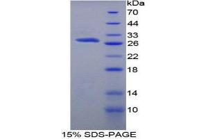 SDS-PAGE (SDS) image for Protein S (PROS) (AA 416-646) protein (His tag) (ABIN2126536)